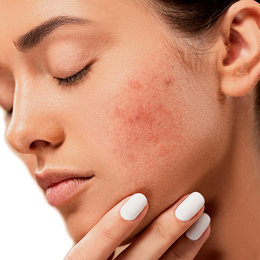 Skin Concern 3 Understanding Hyperpigmentation: Causes and Effects